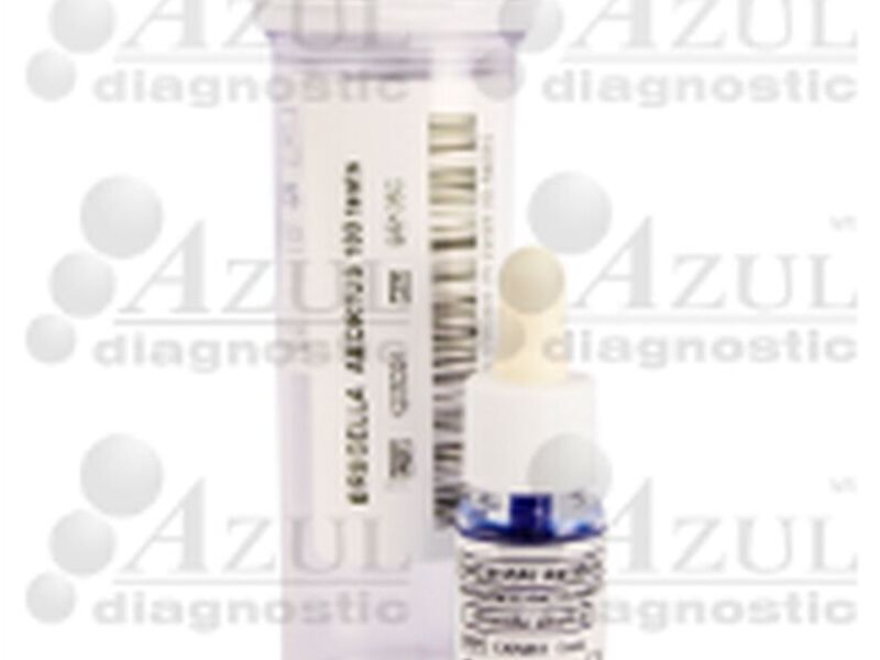 BRUCELA ABORTUS (5 ml) (Spinreact)