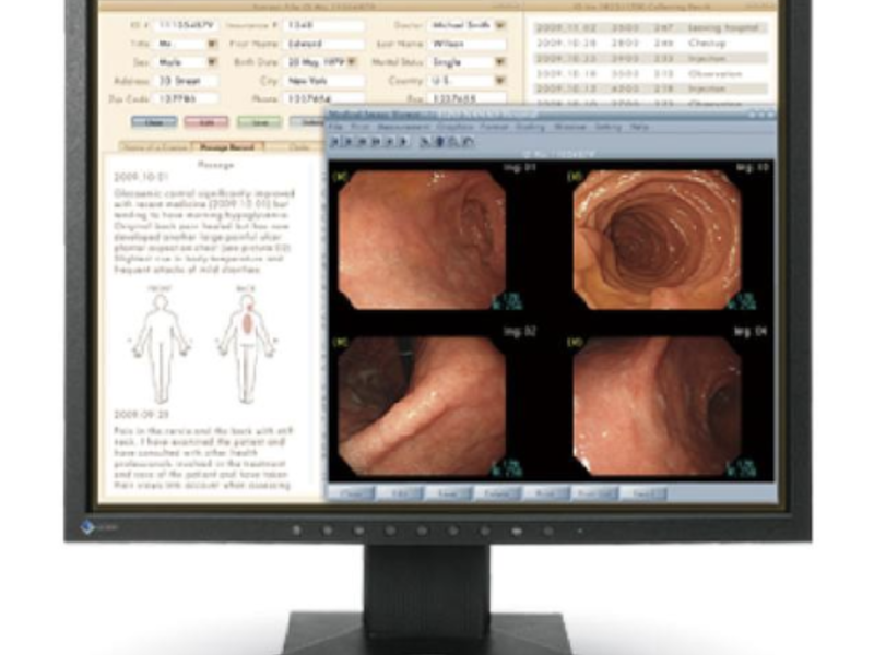 Monitor de grado médico México