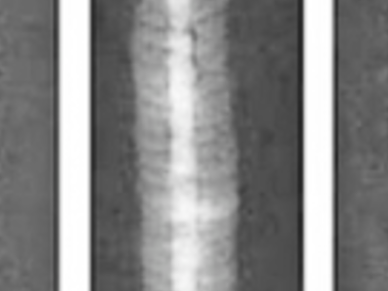 Radiografía Soldados EDO MEX