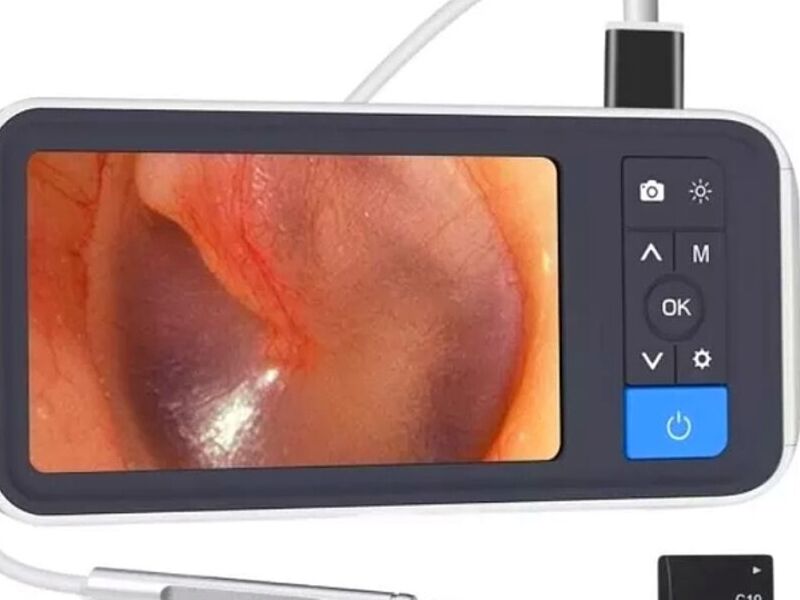 Otoscopio Digital 32gb México 