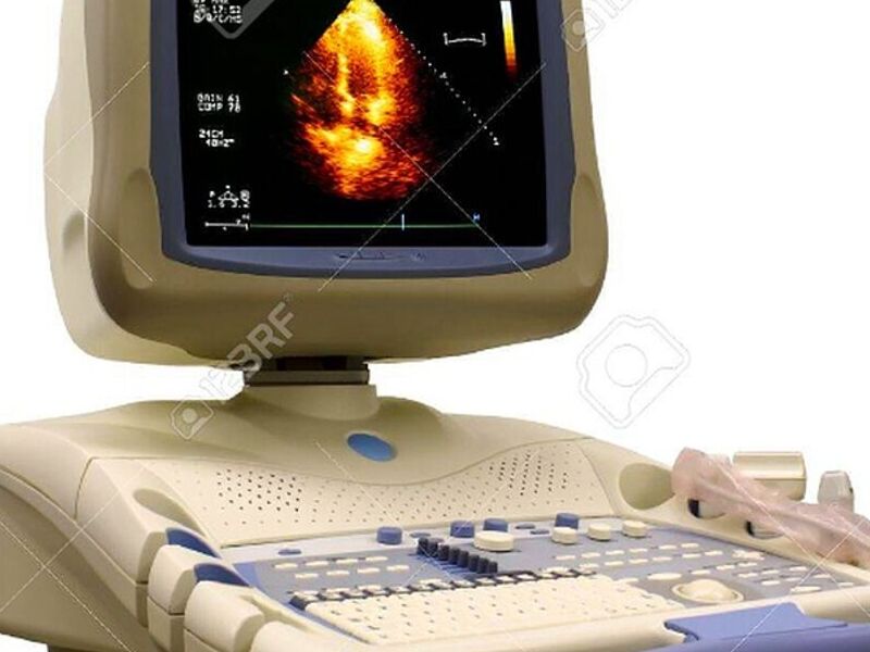 monitor de ultrasonido mexico