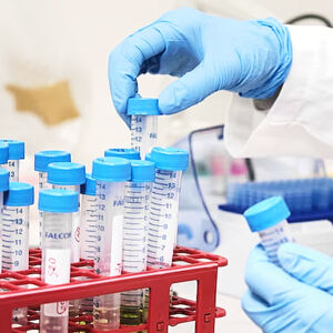 Preparación de muestras